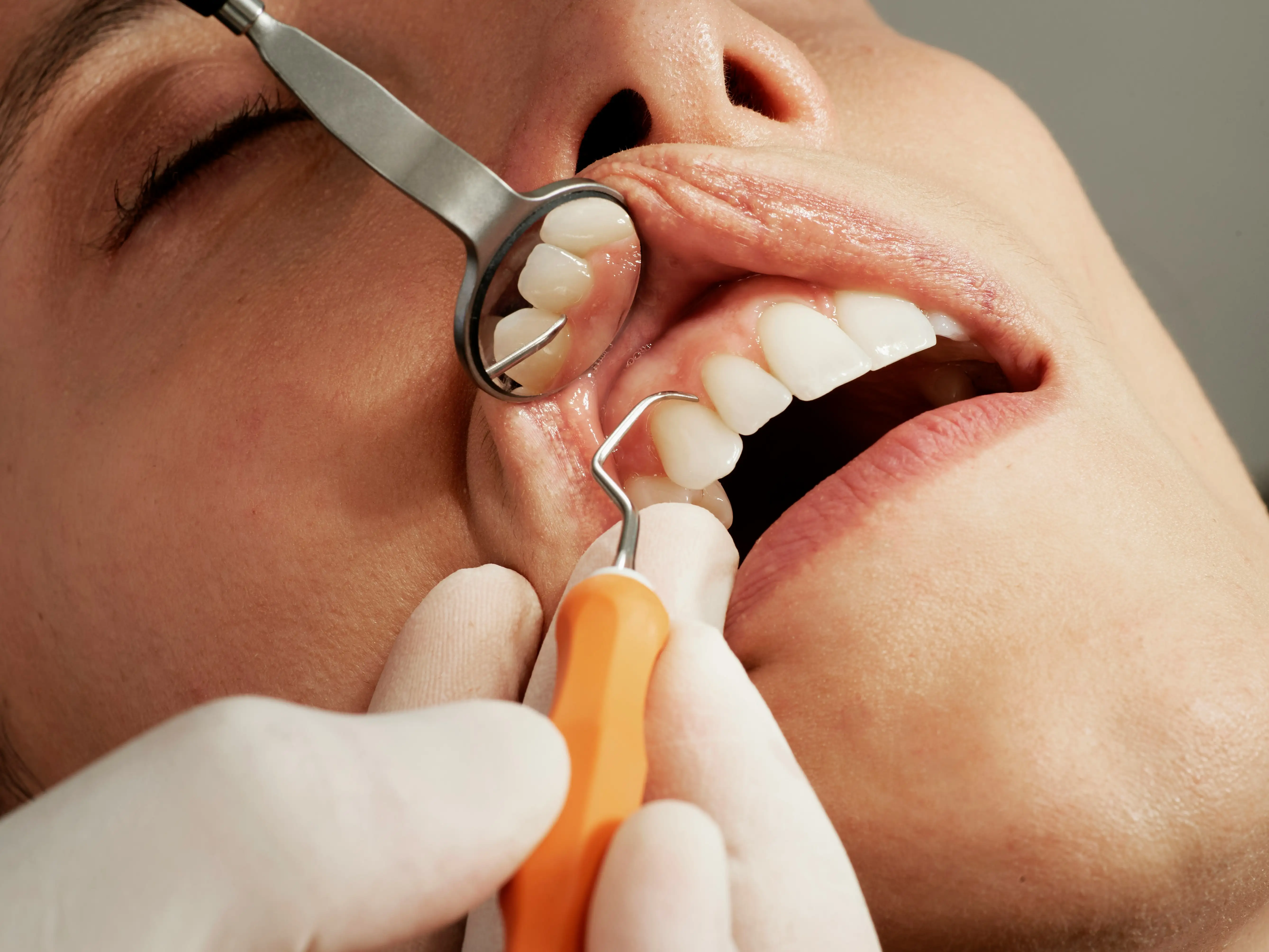 Emergency Dental Care